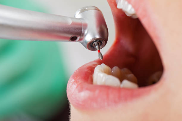 Best Emergency Dental Care for Sports Injuries in Schler Park, IL